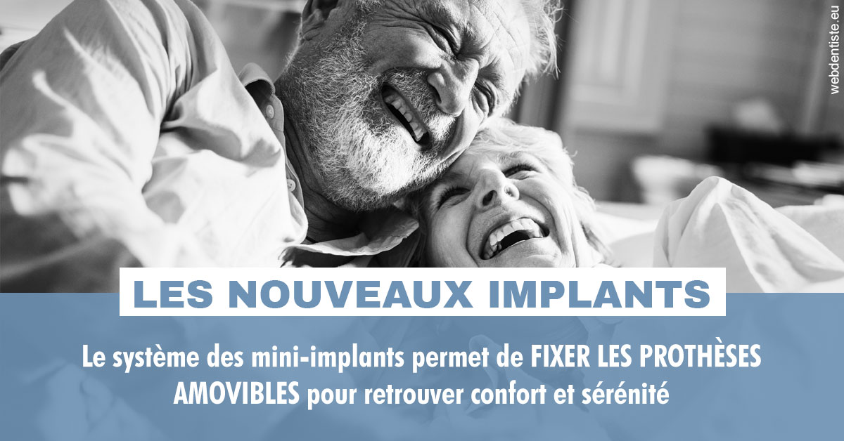 https://www.cabinetdentairepointerouge.fr/Les nouveaux implants 2