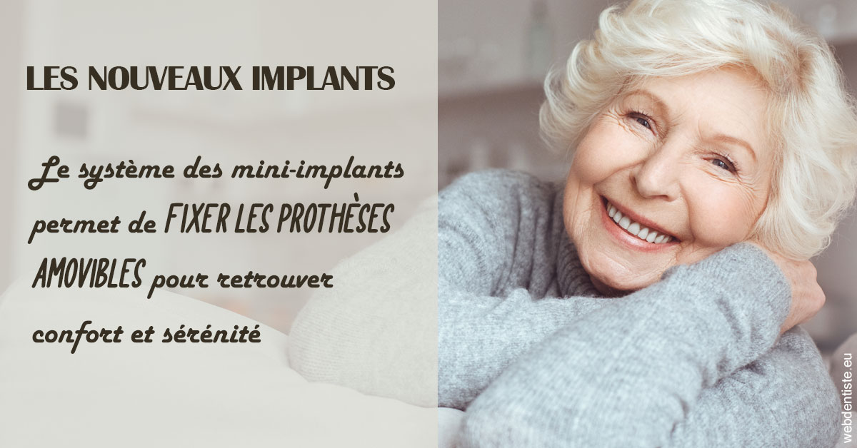 https://www.cabinetdentairepointerouge.fr/Les nouveaux implants 1