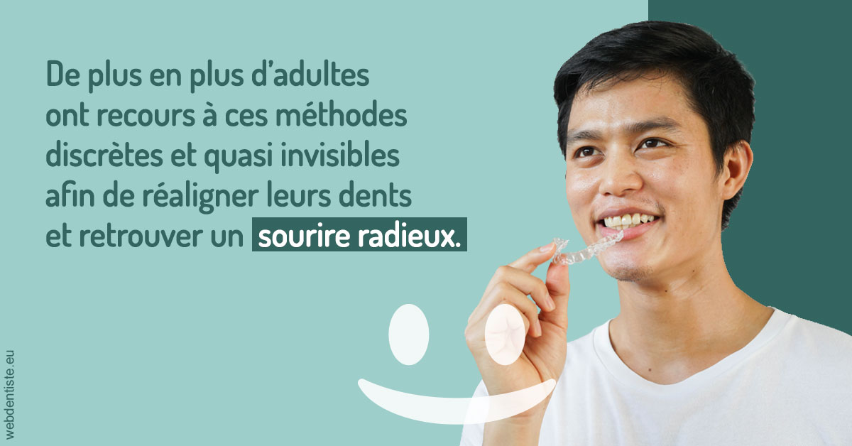 https://www.cabinetdentairepointerouge.fr/Gouttières sourire radieux 2