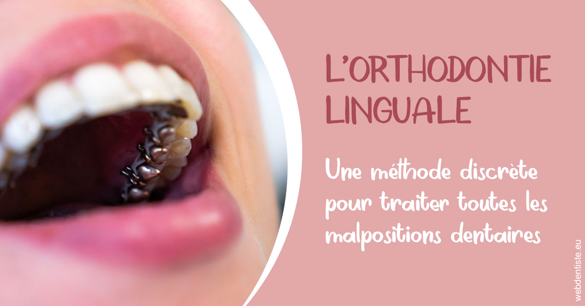 https://www.cabinetdentairepointerouge.fr/L'orthodontie linguale 2