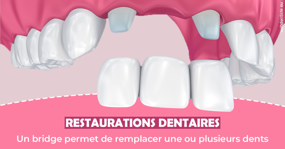 https://www.cabinetdentairepointerouge.fr/Bridge remplacer dents 2