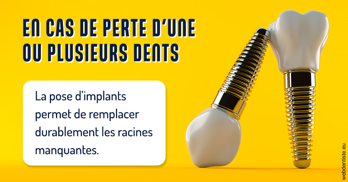 https://www.cabinetdentairepointerouge.fr/2024 T1 - Implants 02