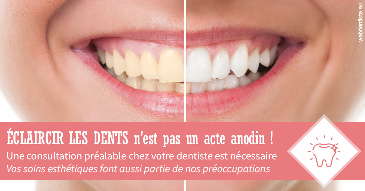 https://www.cabinetdentairepointerouge.fr/Eclaircir les dents 1