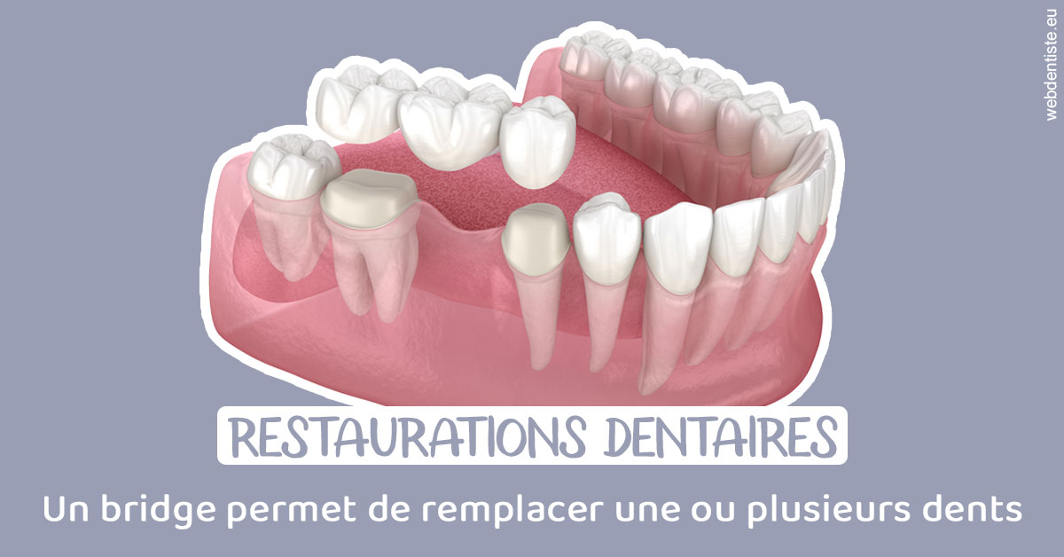 https://www.cabinetdentairepointerouge.fr/Bridge remplacer dents 1
