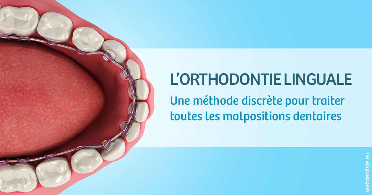 https://www.cabinetdentairepointerouge.fr/L'orthodontie linguale 1