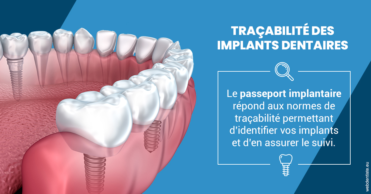 https://www.cabinetdentairepointerouge.fr/T2 2023 - Traçabilité des implants 1