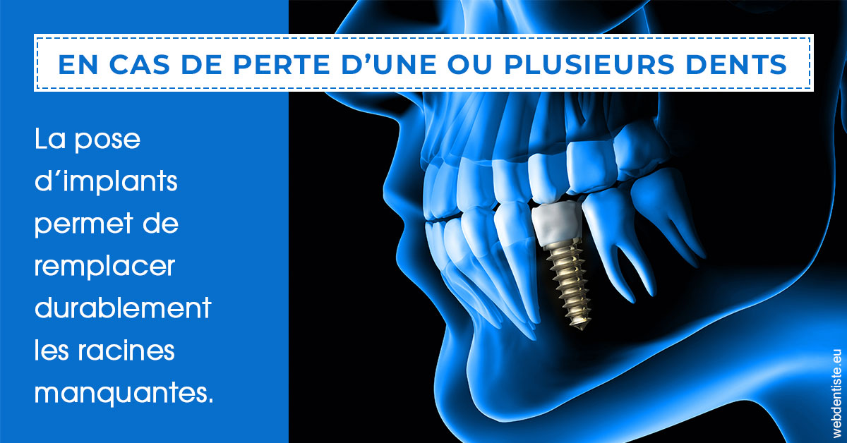 https://www.cabinetdentairepointerouge.fr/2024 T1 - Implants 01