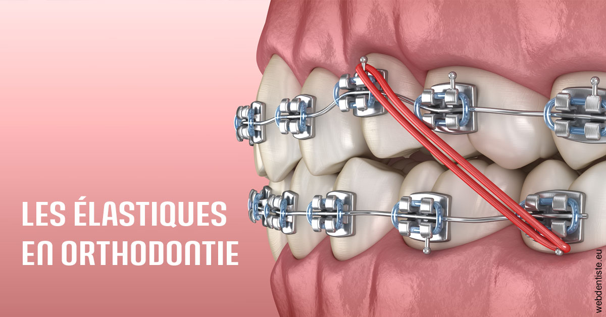 https://www.cabinetdentairepointerouge.fr/Elastiques orthodontie 2