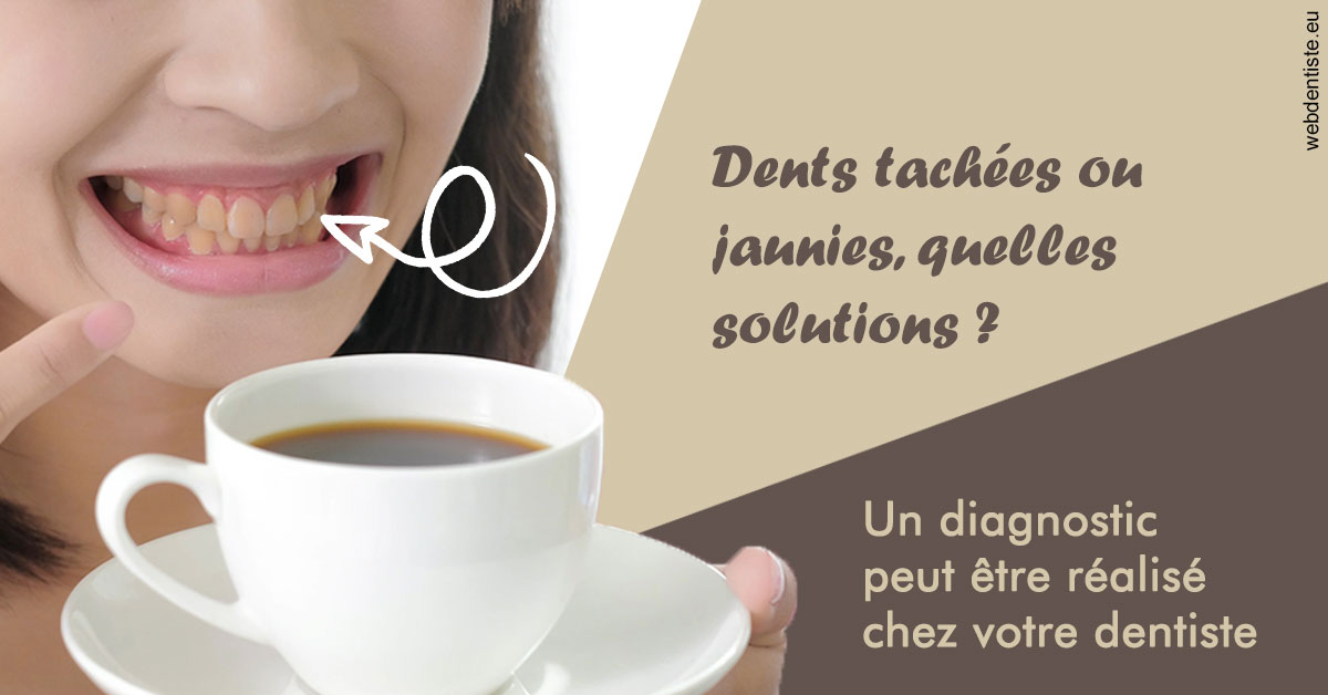 https://www.cabinetdentairepointerouge.fr/Dents tachées 1