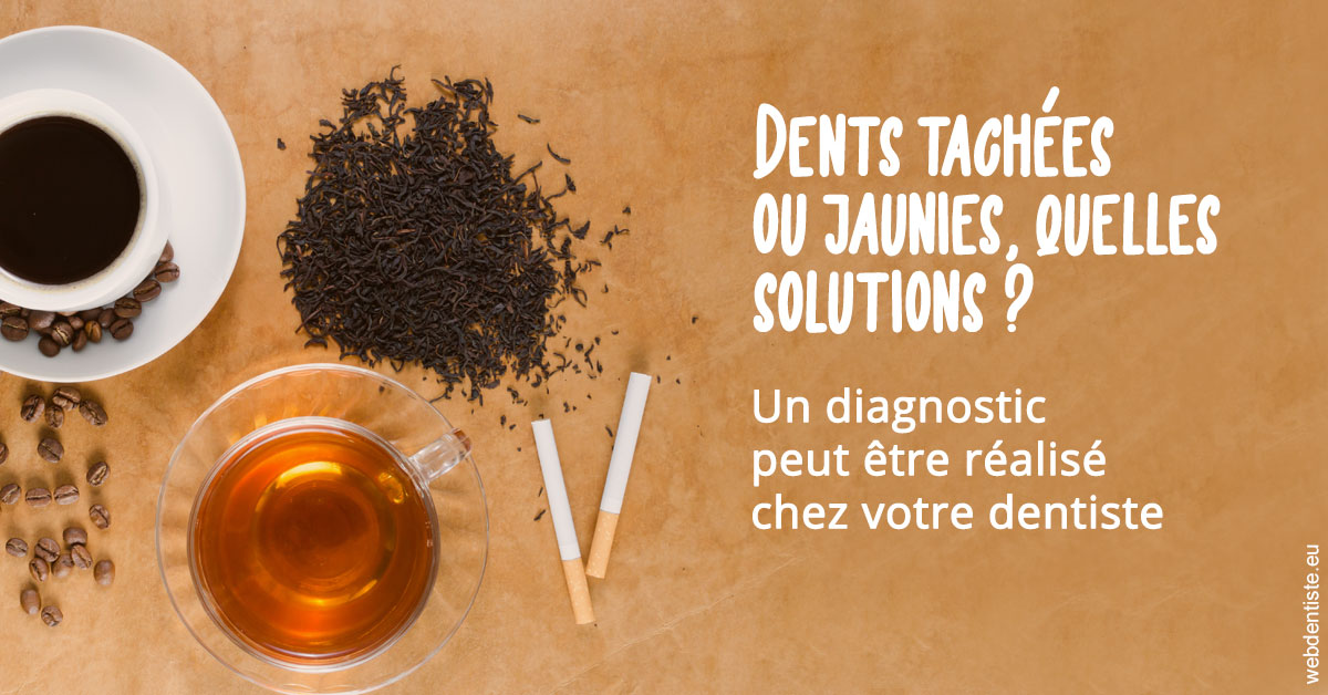 https://www.cabinetdentairepointerouge.fr/Dents tachées 2