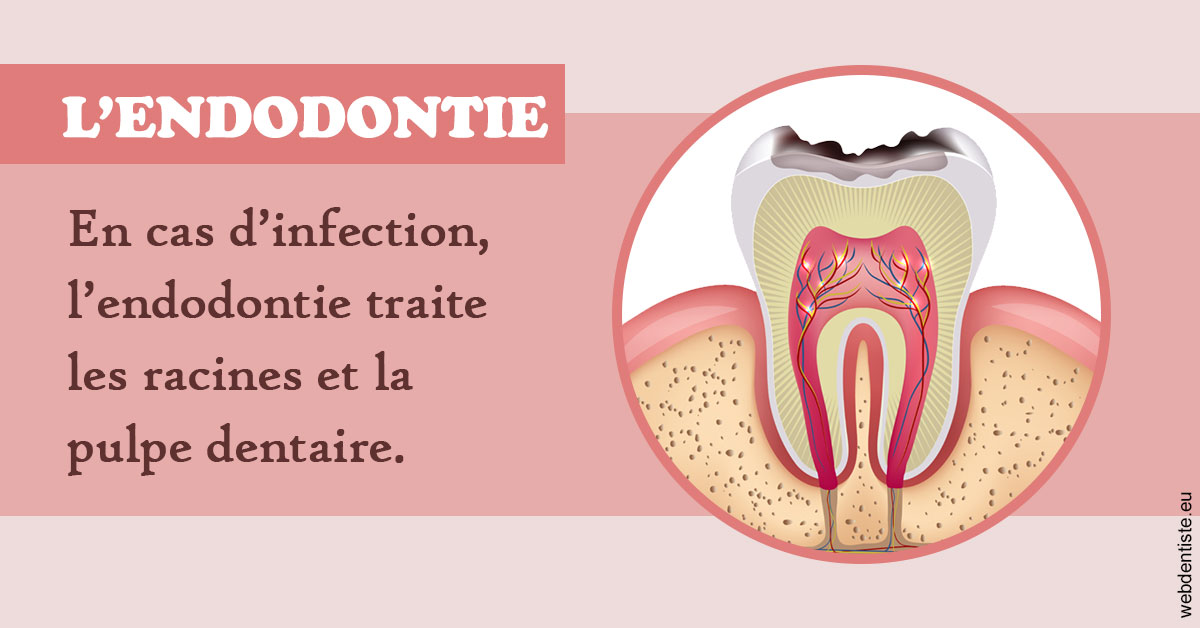 https://www.cabinetdentairepointerouge.fr/L'endodontie 2
