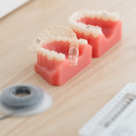 Alignement dentaire invisible à Marseille